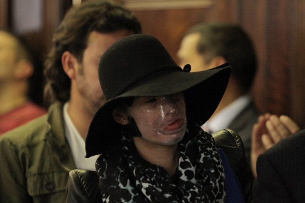 Natalia Ponce de León, una de las tantas víctimas de ataques con ácido.