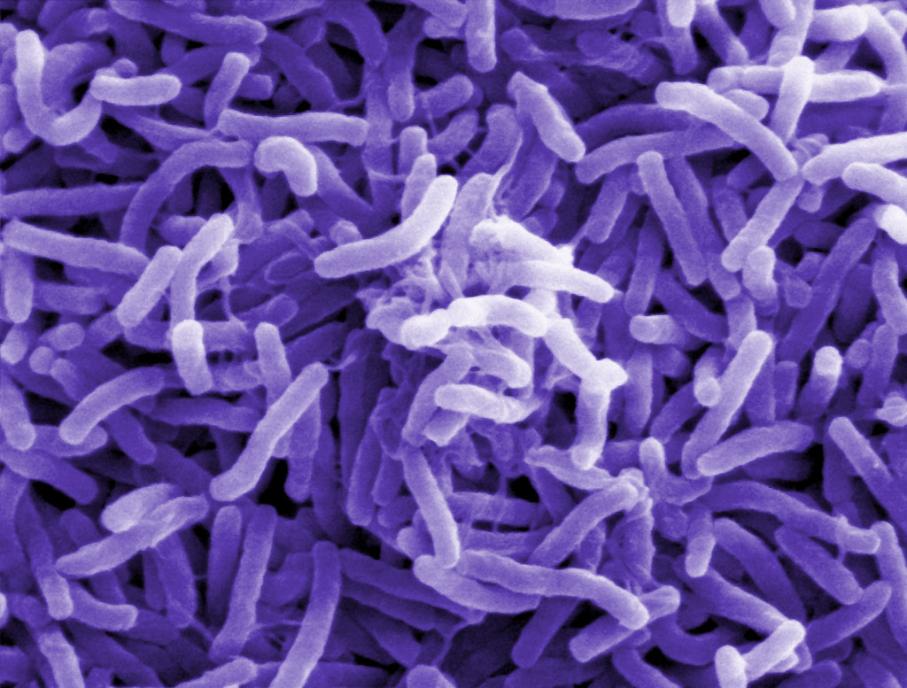 Imagen de la "Vibrio cholerae", la bacteria causante del cólera.