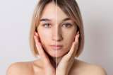¿Cómo quitar las manchas de la cara? Esta es la formula con bicarbonato y miel