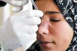 Decretan emergencia en Uruguay por casos de Leishmaniasis