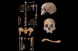 Lo que “olvidó” contar el artículo en Science de la historia de la sífilis en Bogotá