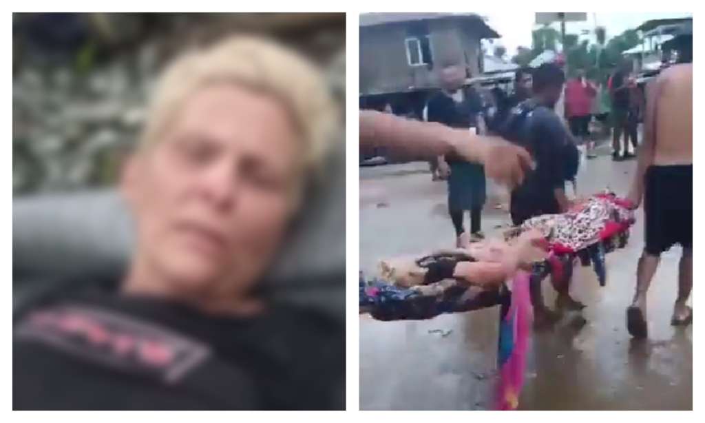Rescatan a migrante con una pierna rota en el Darién; fue abandonada por su hijo