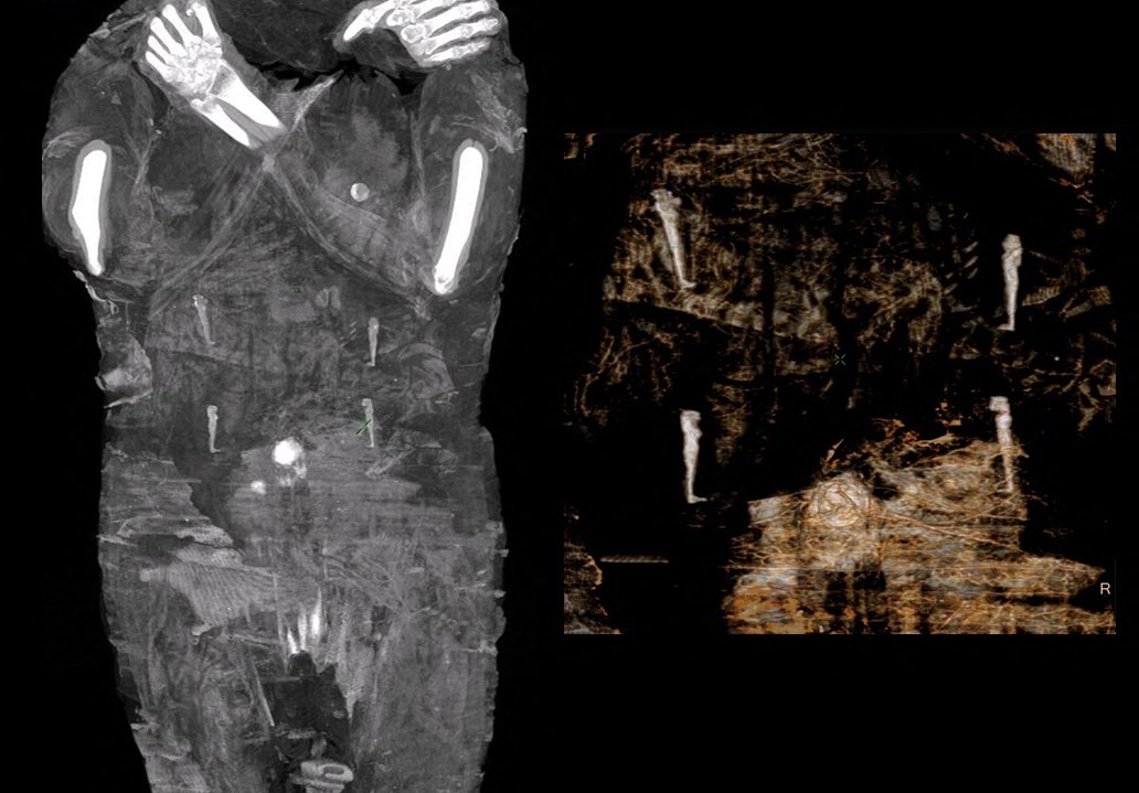 La momia de esta mujer embarazada tiene unos 2.000 años de antigüedad.