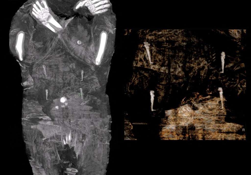 La momia de esta mujer embarazada tiene unos 2.000 años de antigüedad.