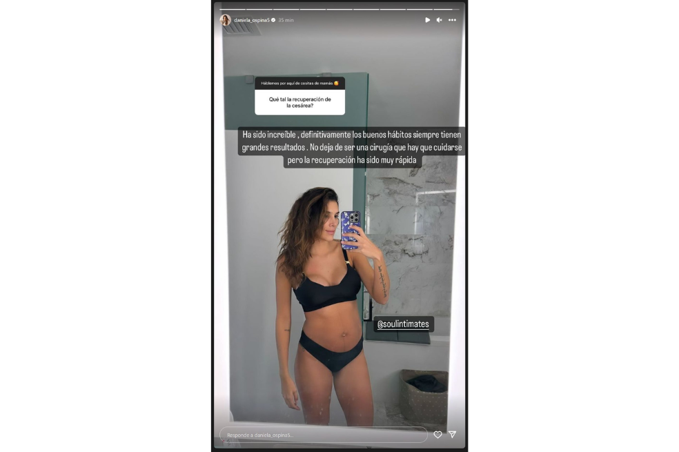Así se ve el abdomen de Daniela Ospina tras dar a luz a su hijo: “increíble”