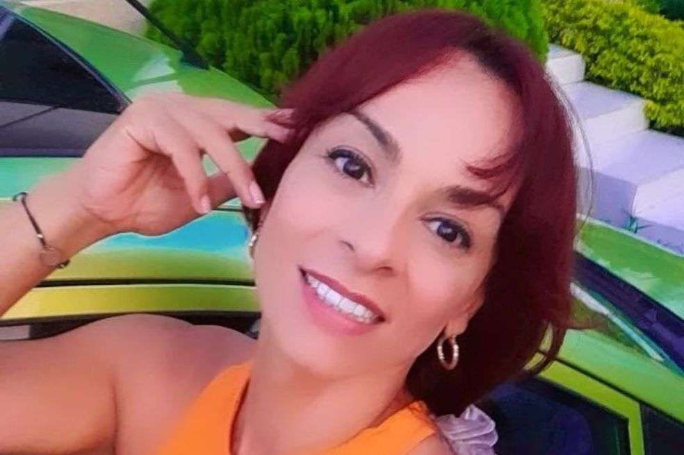 La actriz Endry Cardeño se mostró afectada por el estado actual de sus piernas tras un procedimiento estético. ¿Qué le pasó?