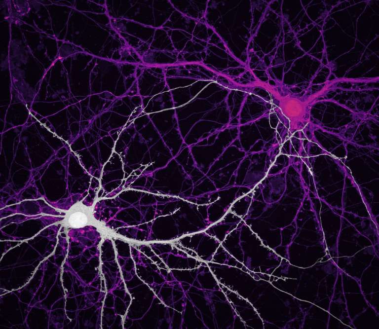 La imagen de unas conexiones entre neuronas del hipocampo (células cerebrales) ocupó el noveno lugar del concurso de fotografía.