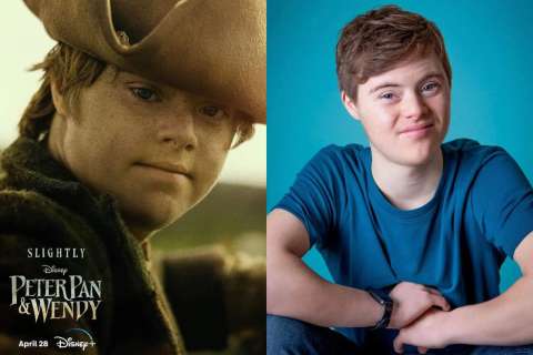 Peter Pan live action tendrá un actor con síndrome de Down, ¿de quién se trata?