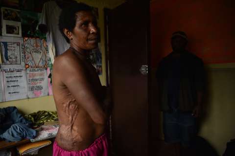 Terror en Papúa Nueva Guinea: maltratan, violan y matan a personas acusadas de brujería