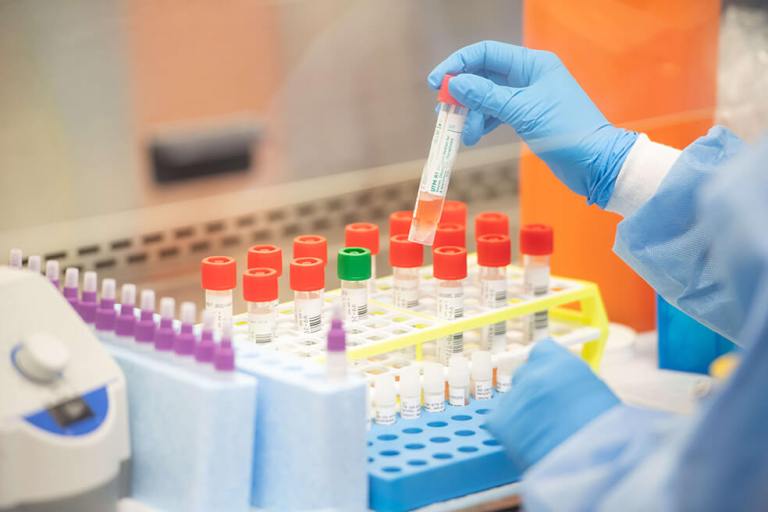 Secretarías de salud no estarían siendo «efectivas» con traslado de pruebas de COVID-19