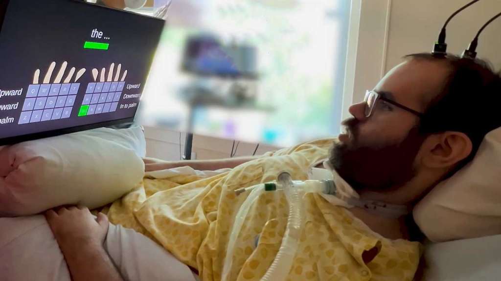 Dos personas con parálisis logran comunicarse rápidamente gracias a una prótesis en el cerebro.