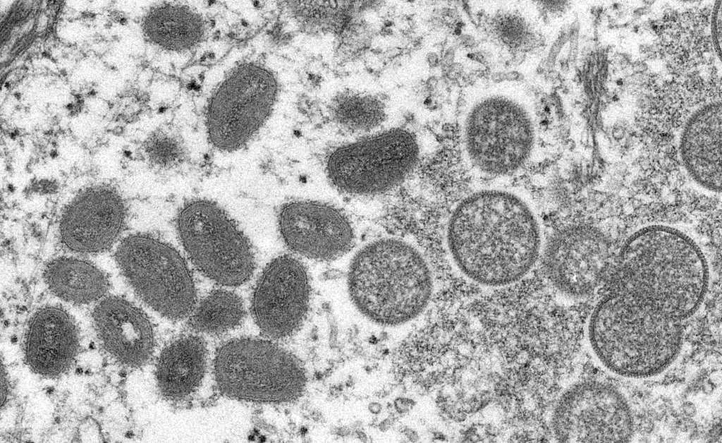 Viruela del mono: esto es lo que debe saber antes de ser presa del pánico