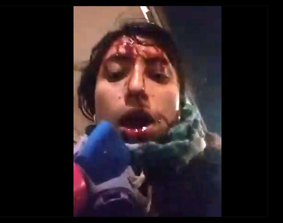 Diana Rocio Pinzón envió un mensaje desde su cuenta de Twitter luego de ser agredida por los uniformados. / Twitter