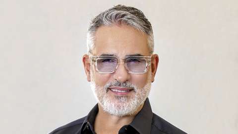 Imagen. No lo creerás. Miguel Varoni revela  increíble transformación de su nariz