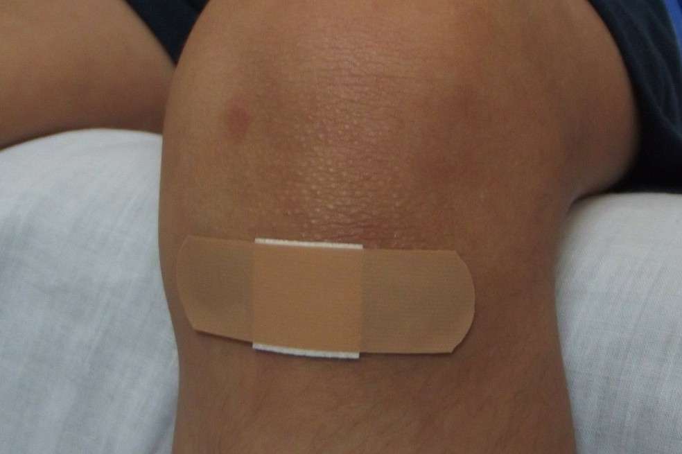 Las heridas menores deben ser correctamente tratadas para evitar que se infecten.