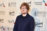 Ed Sheeran se accidentó en su bicicleta y se fracturó el brazo