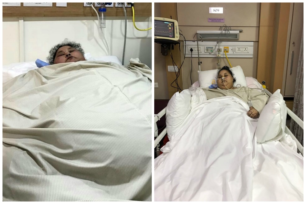 Eman Ahmed Abd El Aty, antes y después de la cirugía.  / AFP