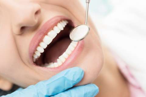 ¿No sabes qué hacerte? Los tratamientos dentales que son tendencia este fin de año