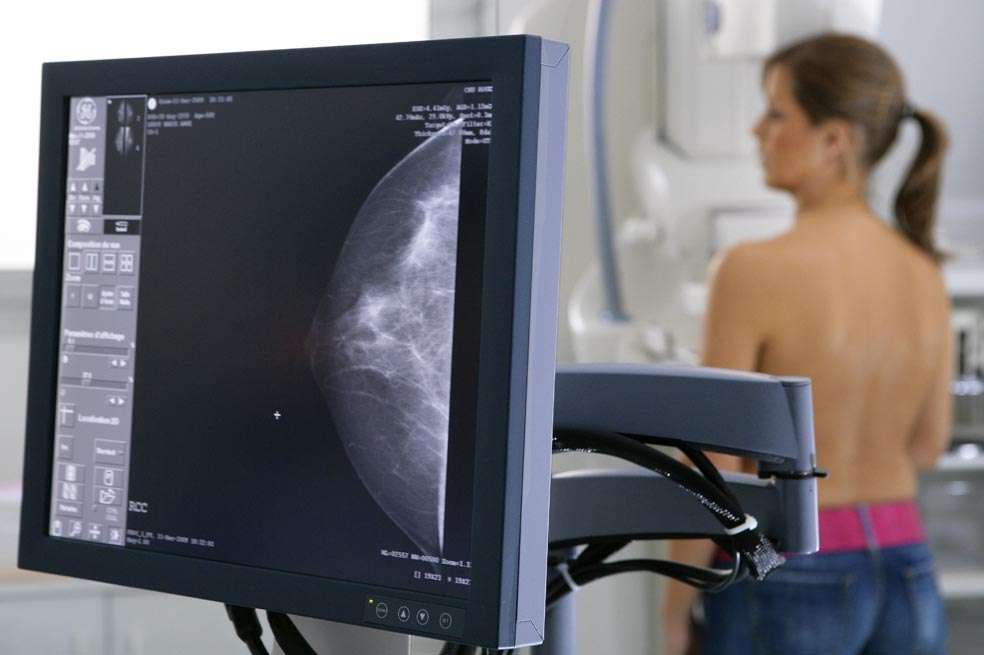 En 30 años, los casos de cáncer de seno en Colombia se han duplicado. / 123rf
