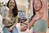 ‘Sugaring’, la peligrosa tendencia de TikTok que provoca graves quemaduras