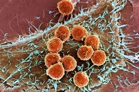 Por primera vez edición genética muestra seguridad en pacientes con cáncer
