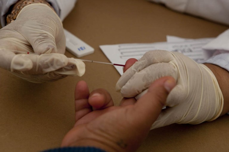 El éxito del tratamiento contra VIH y Hepatitis C, según las matemáticas