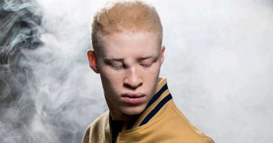 Shaun Ross, el primer albino en pisar una pasarela