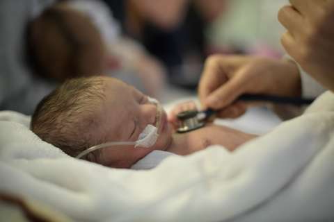 La crisis de Canguro, el programa que ha salvado miles de bebés prematuros