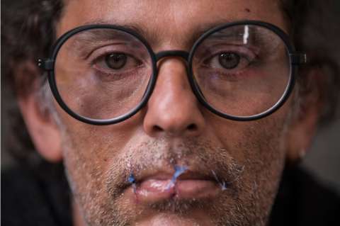 John Fitzgerald, el artista que se cosió la boca para protestar