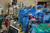 Un paciente sobrevivió más de 48 horas sin pulmones y conectado a un órgano artificial