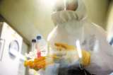 Colombia suma 582.022 casos confirmados de coronavirus este 27 de agosto