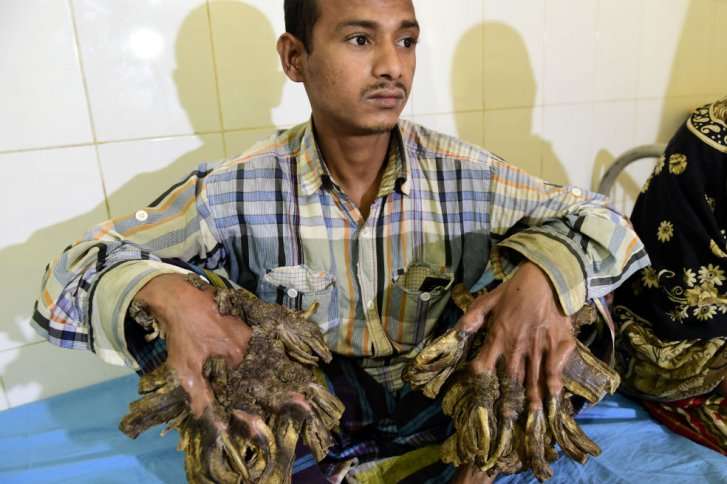 Abul Bajandar. / AFP
