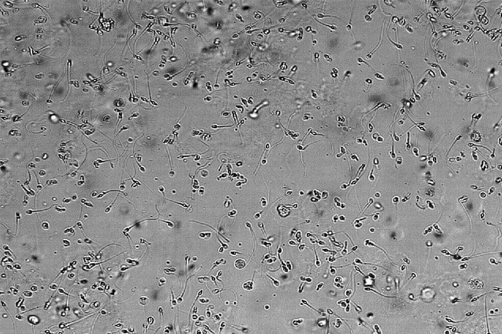 Durante el trasplante de células sanguíneas hematopoyéticas, éstas pueden desplazar las células huésped de la médula ósea en su totalidad o en parte. Hasta el momento se creía que eso no pasaba. / Wikimedia Commons