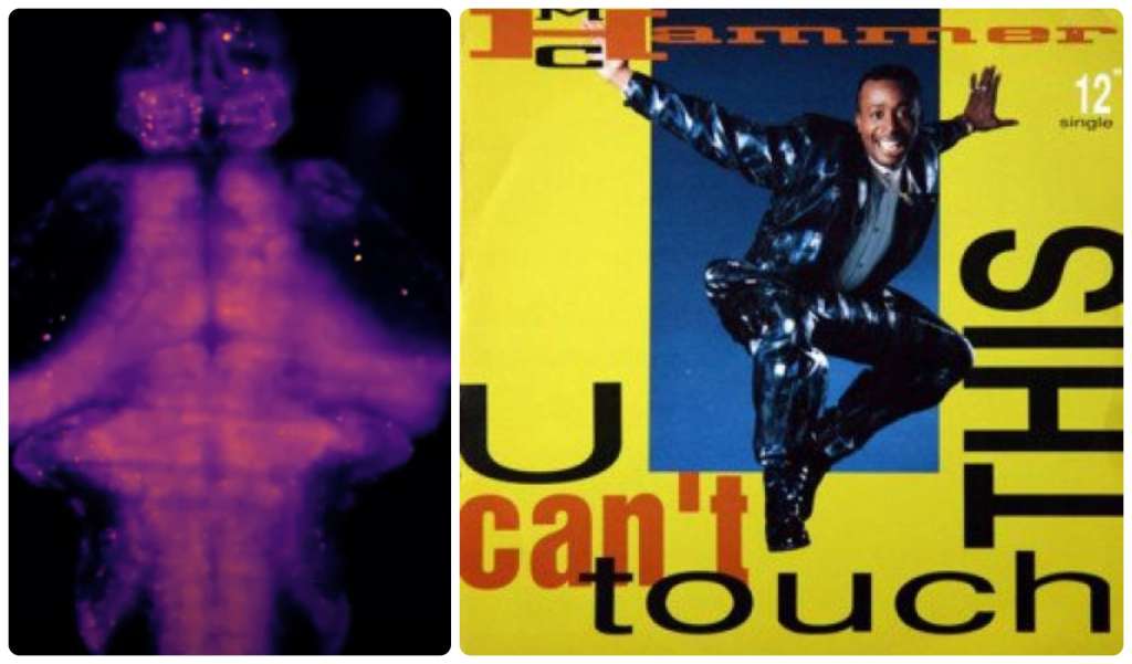 A la izquierda una imagen del cerebro de un pez zebra en las primeras etapas de desarrollo en la que se observa la reacción al escuchar música. A la derecha imagen del rapero MC Hammer cuya música se usó para el experimento.
