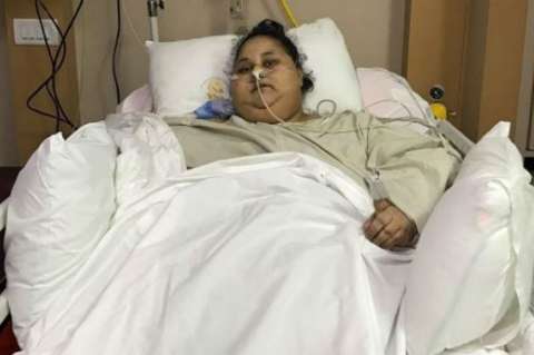 Mujer más obesa del mundo pierde 250 kilos tras operación en India
