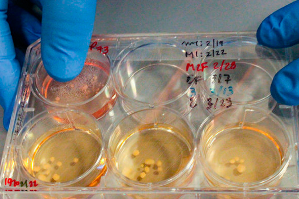 Muotri se enfocó en uno de 200 genes codificadores de proteínas que difieren entre neandertales y humanos modernos. / Tomado de Agencia de noticias N +1