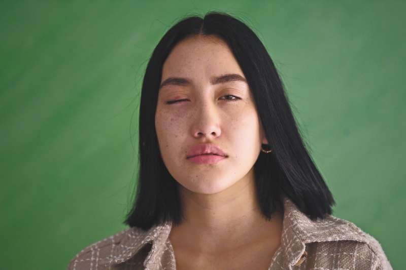 Leidy Cadena - Joven que fue victima de la Violencia por parte del Esmad