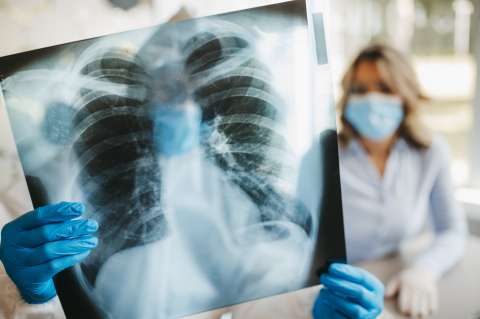 Cada día, 57 colombianos reciben un diagnóstico de tuberculosis