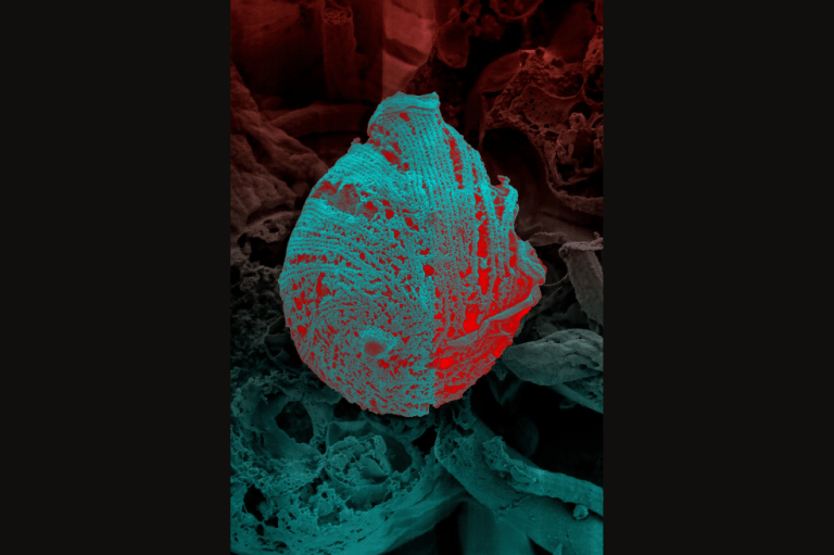 Esta es la estructura interna del Trypanosoma cruzi, o T. cruzi, el parásito que causa la enfermedad de Chagas, una enfermedad tropical transmitida por picaduras de insectos o alimentos contaminados. Con el tiempo, puede causar graves afecciones cardíacas y problemas digestivos, especialmente si no se trata. La enfermedad de Chagas afecta de forma desproporcionada a las poblaciones rurales y de bajos ingresos de las Américas, y se considera una enfermedad poco estudiada.