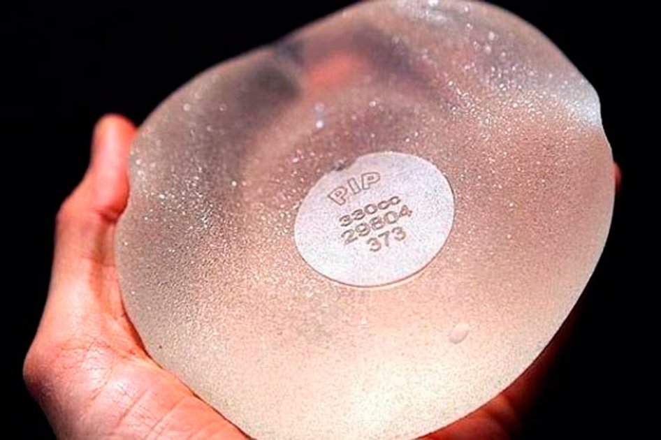 Implantes mamarios PIP (Poly Implant Prothèse). / EFE
