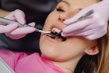Desde aclaramientos hasta lentes cerámicos, la tendencia de los diseños de sonrisa