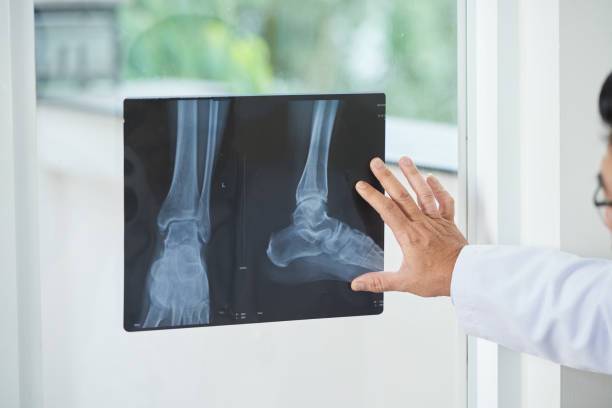 Cerca del 45% de los humanos no tendría este hueso, ¿cuál es?
