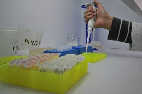 Por primera vez identifican en Colombia la enfermedad que provoca caída de los párpados
