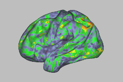 Así se ve el cerebro en un ‘viaje’ psicodélico
