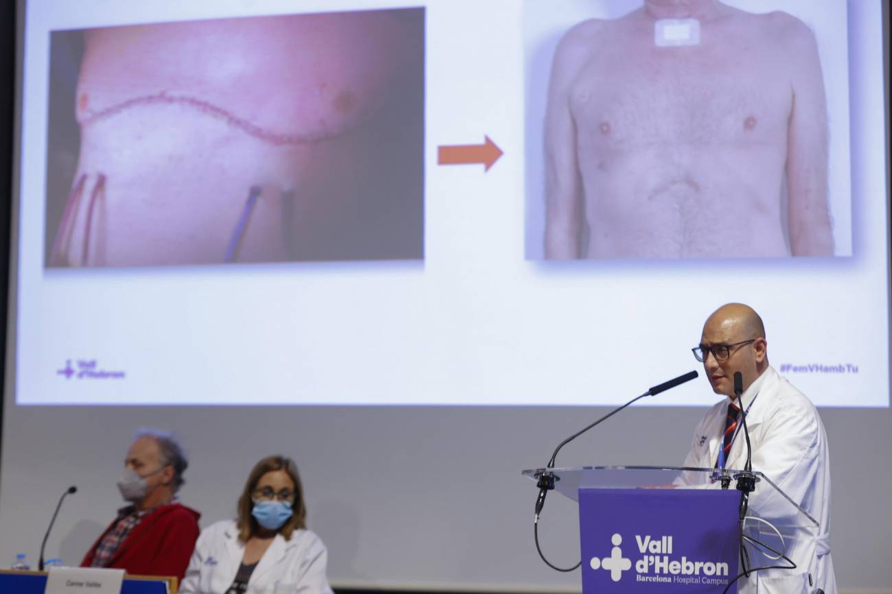 El procedimiento se llevó a cabo en el Hospital Universitario Vall d’Hebron, en España.