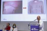 Realizan el primer trasplante de pulmón completamente robótico sin abrir el tórax