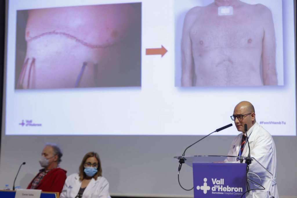 El procedimiento se llevó a cabo en el Hospital Universitario Vall d’Hebron, en España.