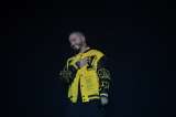 J Balvin sufrió un accidente y tuvo que ser enyesado