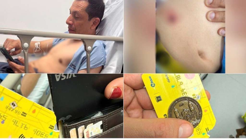 El funcionario resultó herido luego de intervenir para auxiliar a un ciclista que estaba siendo víctima de un robo en el norte de Bogotá.