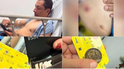 Funcionario de MinInterior fue herido al intentar evitar un robo en Bogotá, esto se sabe